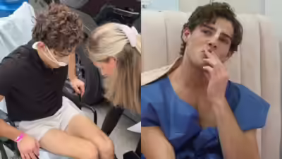 Claviculars new rhinoplasty recovery photos spark leg lengthening surgery speculation.jpg