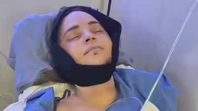 Youtuber rosanna pansino undergoes surgery after breaking jaw in boat accident.jpg