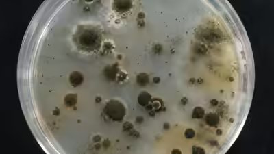 How chornobyl39s mysterious fungus could change medicine and future space missions.jpg
