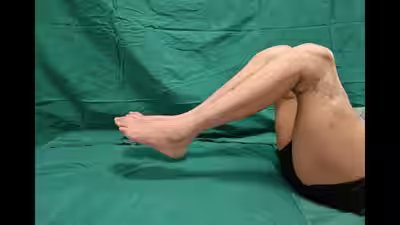 A chinese factory worker got two new legs implanted after he lost both his legs in an accident.jpg