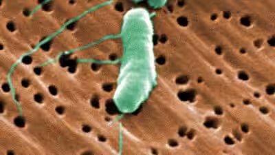 Florida39s first flesh eating bacteria death of 2026.jpg